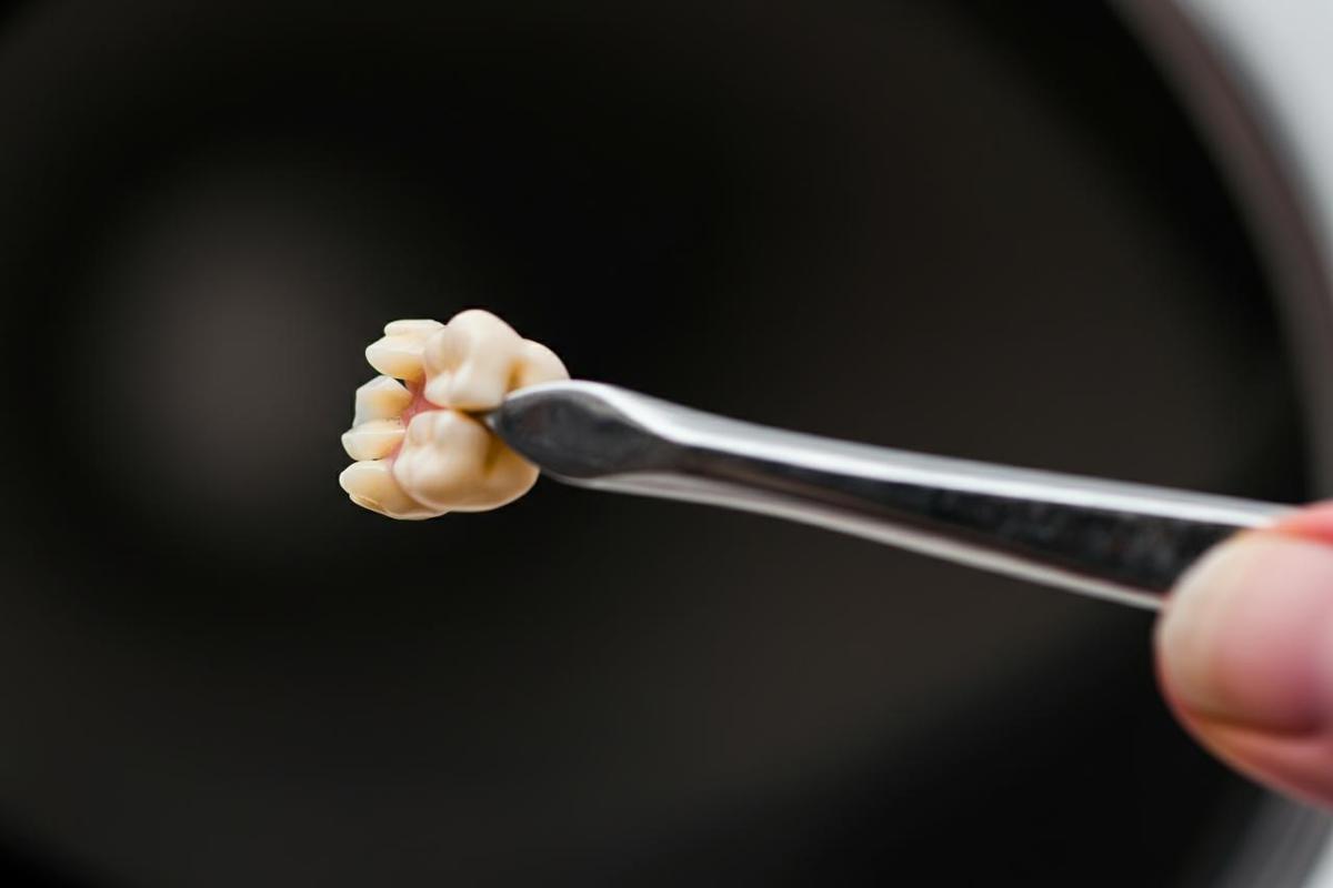 Utilizzo errato dello spazzolino: rischi per la salute dentale